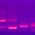 Microfluidics for DNA analysis DNA Electrophoresis