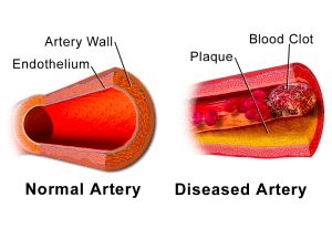 Lung-on-chip Schema of blood clot