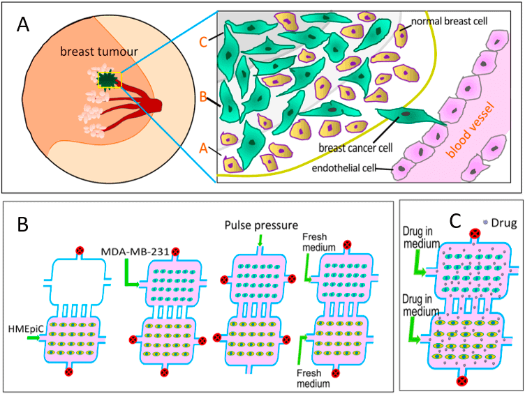 Microfluidic Tumor-on-chip Systems For Breast Cancer Research - Elveflow