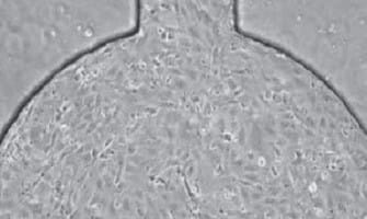 Cell culture under perfusion for microscopy live cell imaging