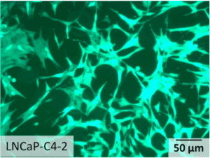 Circulating_tumor_cells_CTC_microfluidics_prostate_cancer_Elveflow