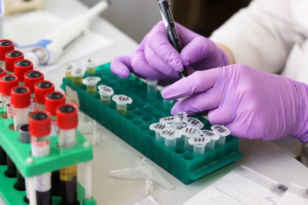 Coronavirus (SARS-CoV2) Diagnostic With Microfluidics - Elveflow