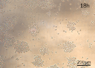 Dynamic cell culture microfluidic perfusion Hela cell 18H