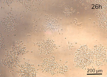 Dynamic cell culture microfluidic perfusion Hela cell 26H