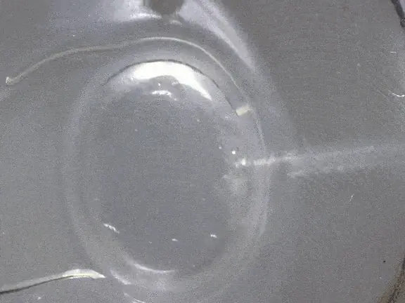 Glaucoma drainage device video