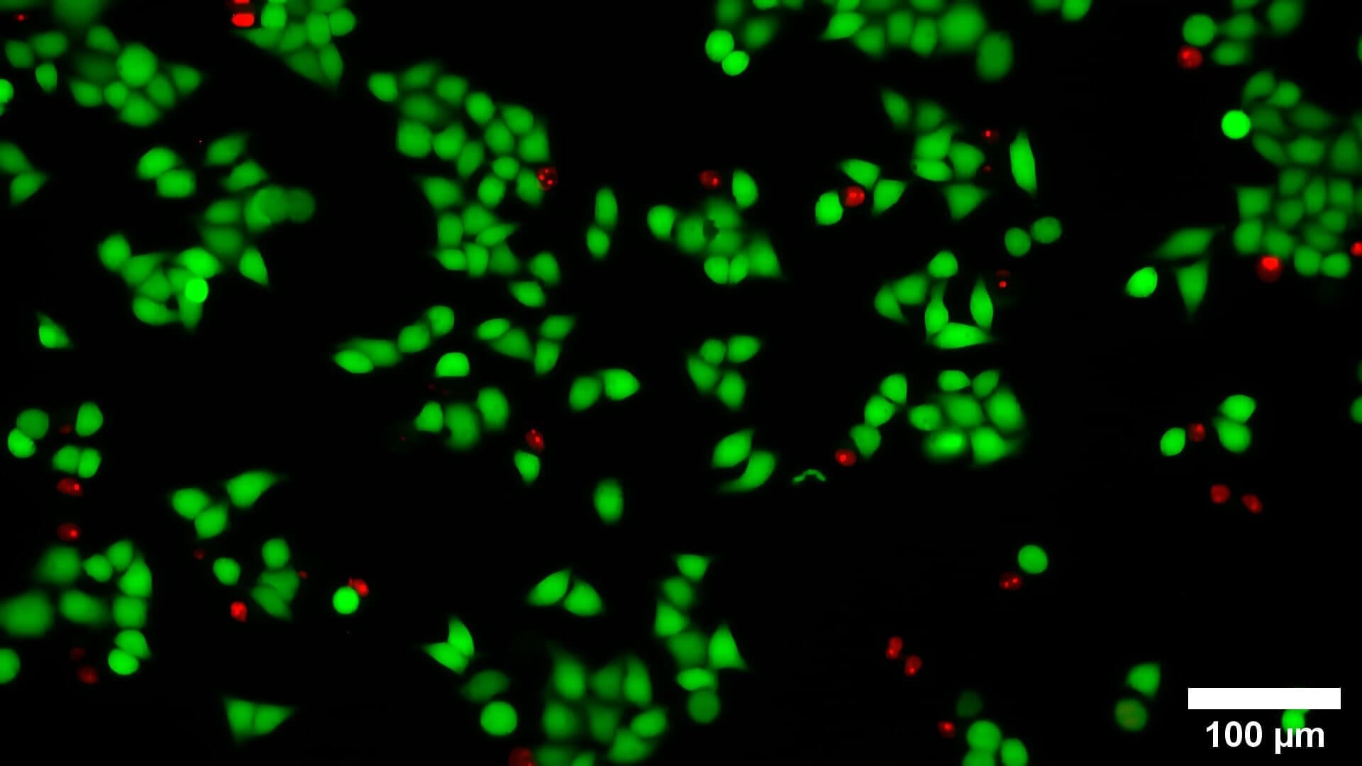 LIVE DEAD Hela cell staining