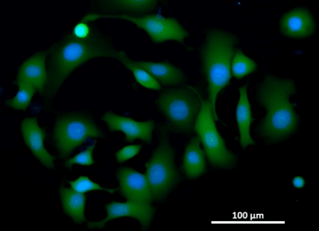 Live cell staining of MCF7 cells title