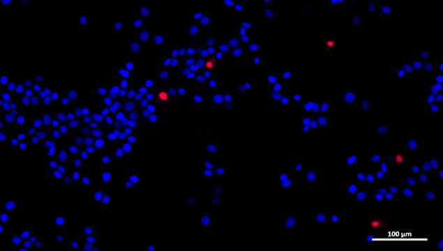 Live dead staining of MCF7 cells