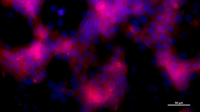 Microscope picture of medium recirculation cells