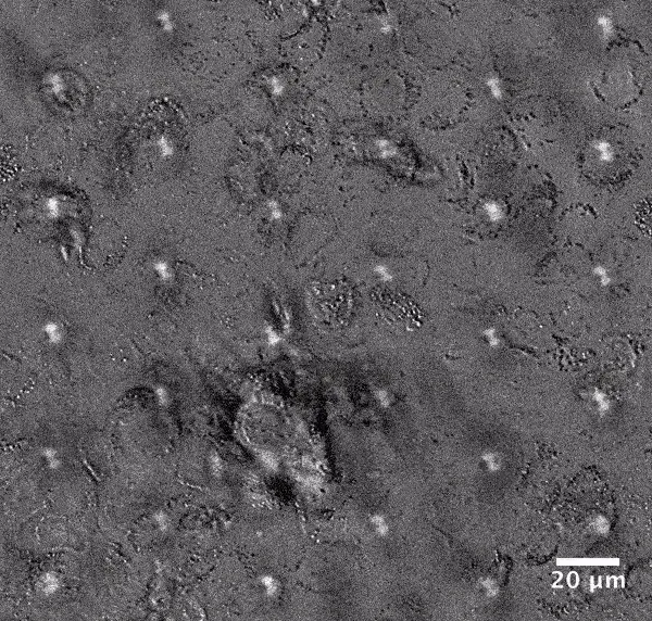 human bladder on chip vide 1