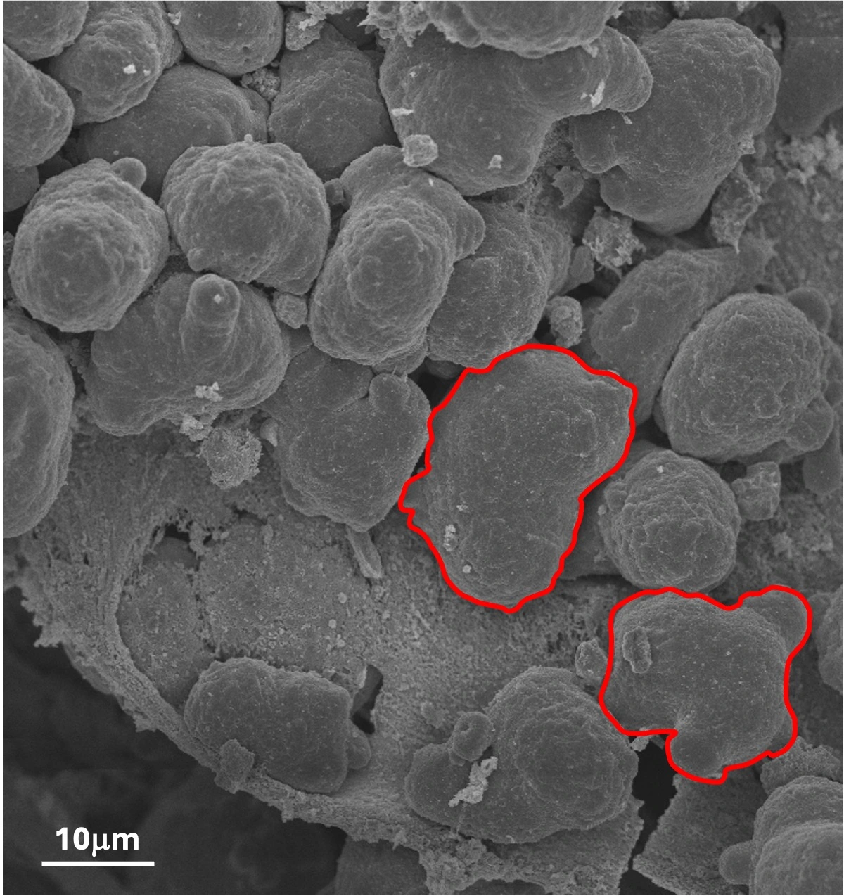 Entamoeba histolytica contoured in red degrading the mucus layer of the human colon, scanning electron microscopy (Institut Pasteur)