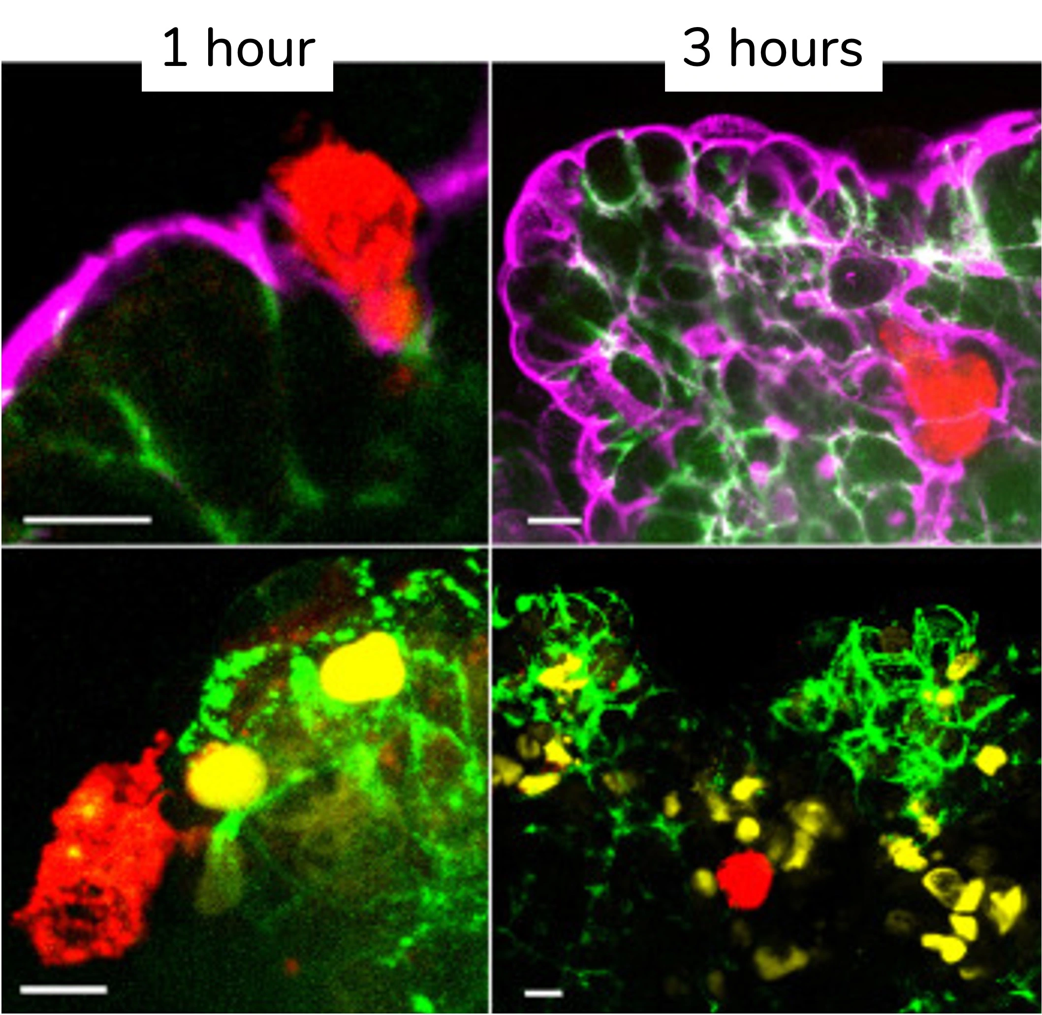 Tissue degradation and invasion process with amoeboid infection at 1 and 3 hours. Red: Amoeba; purple: actin; green: E-cadherin; yellow: dead cells (scale bar 20 µm).