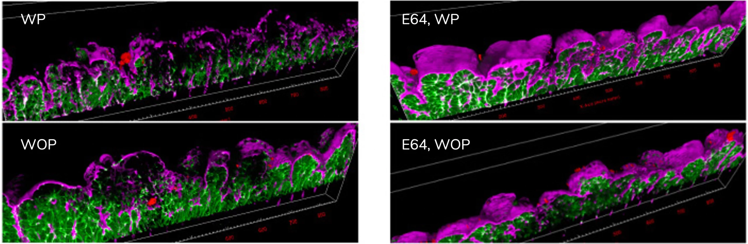 Confocal z-stack, 7 hours after Amoeba infection. Left without cysteine protease inhibitor, right with cysteine protease inhibitor (E64), top with peristaltic motion, bottom without peristaltic motion.