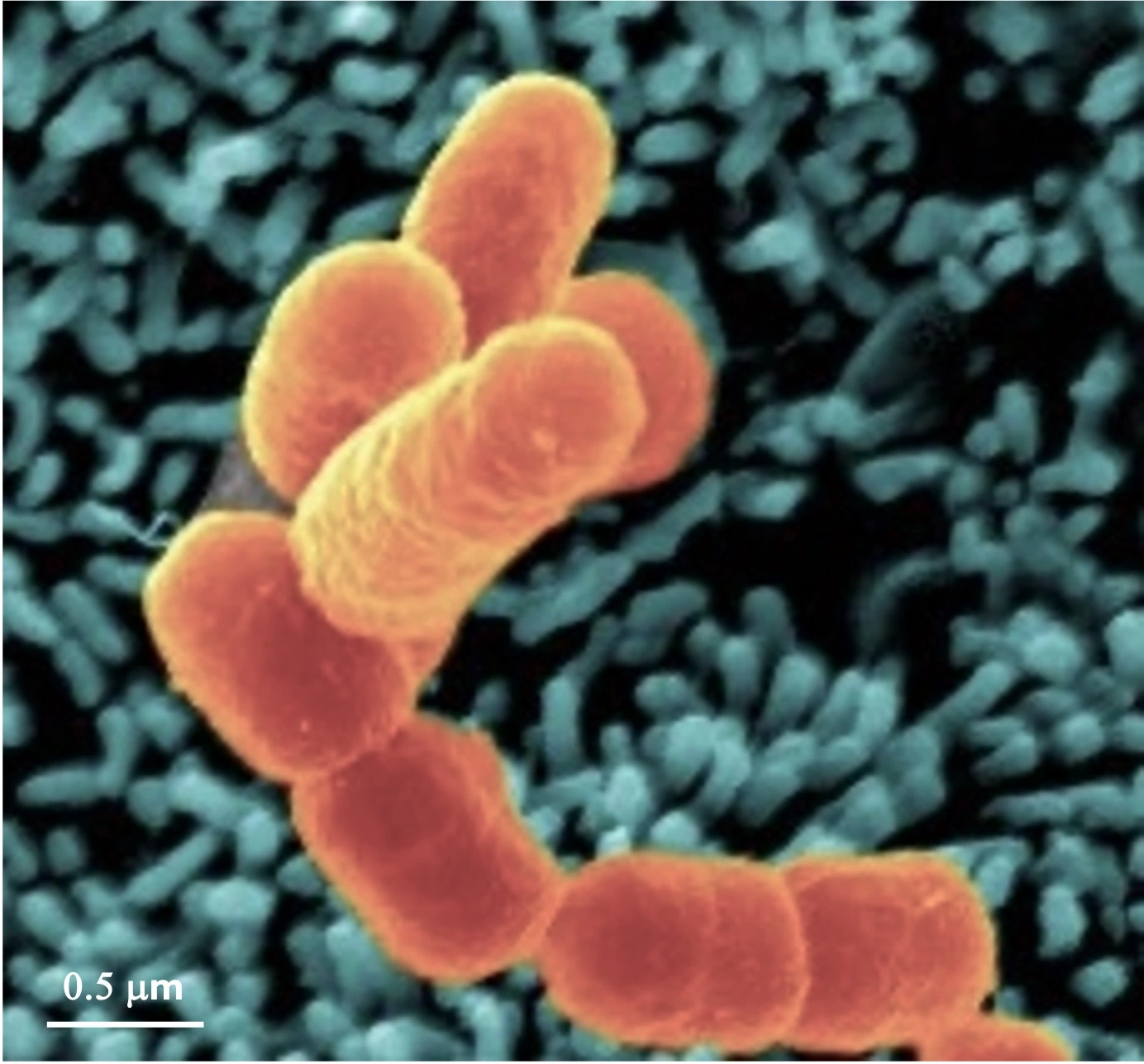 Shigella flexneri invading human intestinal epithelial cells, Scanning Electron Microscopy (Institut Pasteur).