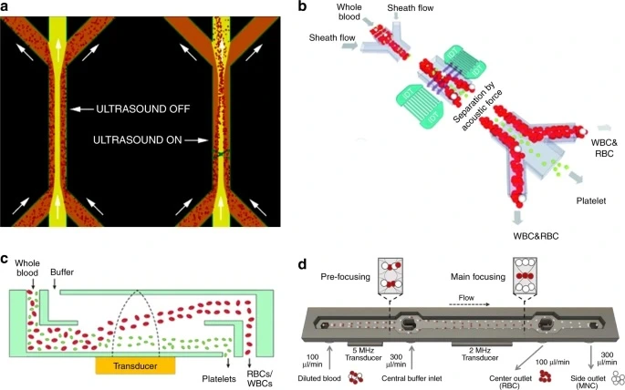 Separating blood cells from plasma by acoustic waves for the applications of blood wash or plasmapheresis (Mengxi Wu, Microsystems & Nanoengineering 2019)