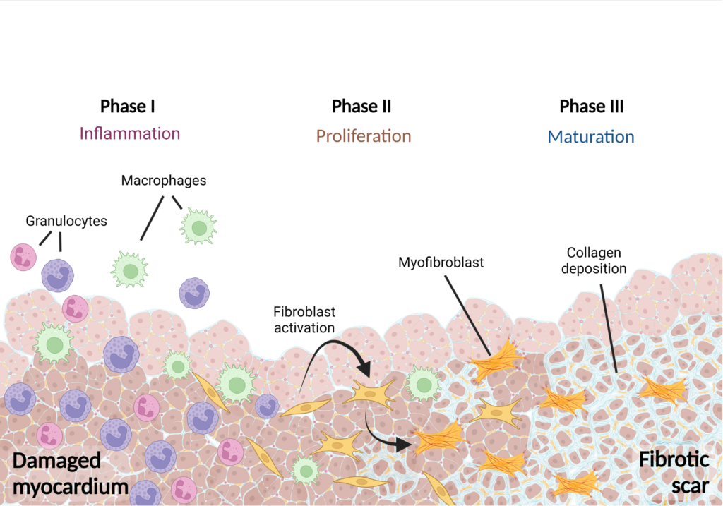 Figure 1. Scheme of myocardial healing phases and fibrotic scar formation following ischemic injury. Created with BioRender.com.