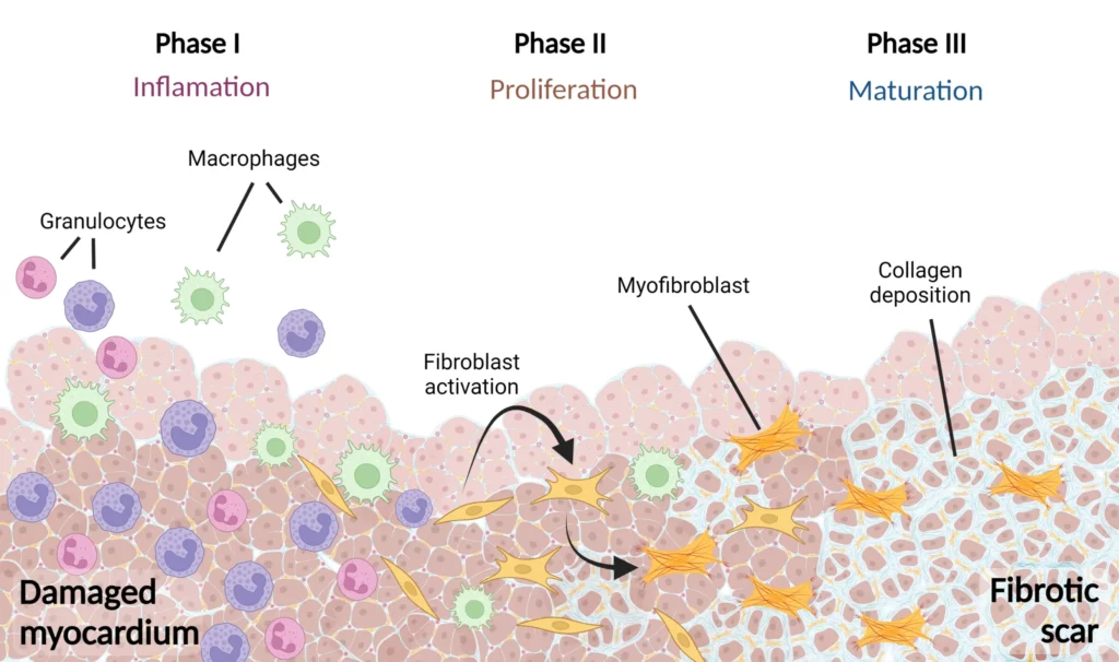 Scheme of myocardial healing phases and fibrotic scar formation following ischemic injury.