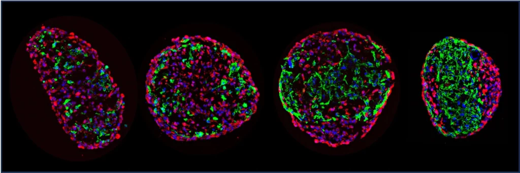 spheroids fibrotic remodeling