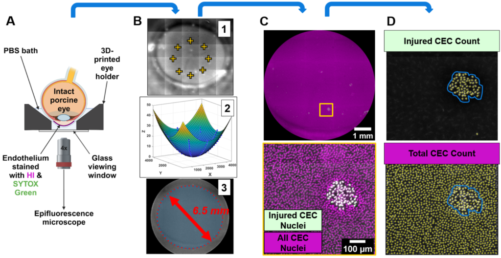 Figure 3 - Imaging workflow: fluorescent z-stack corneal endothelial images