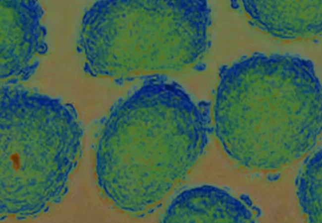 PVA-microspheres-in-drug-delivery-Microfluidics-innovation-center