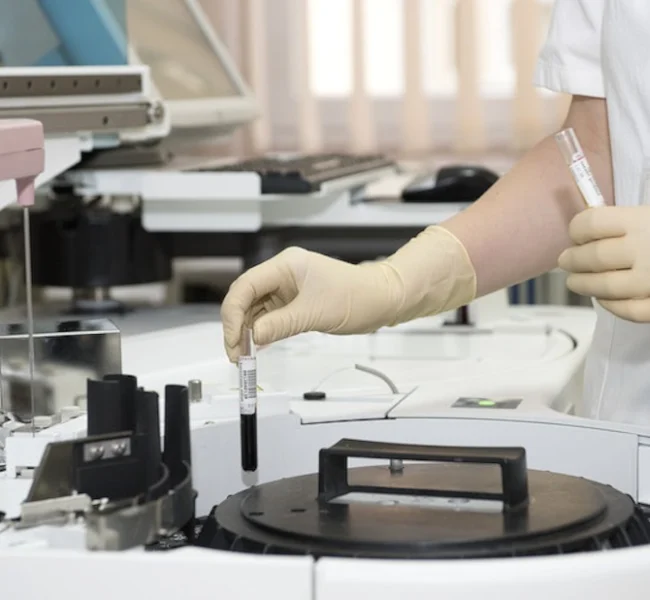 Radiactivity handling